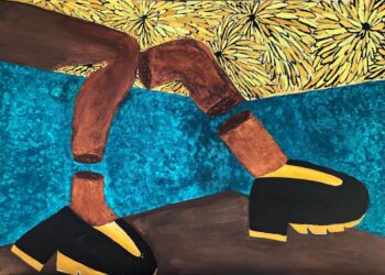 Fishnet Stockings And Scars: Beauty In Imperfection